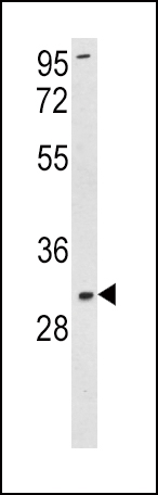 SOD3 (N-term)
