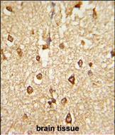 Rabbit Polyclonal Antibody to DLX2