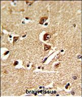 Rabbit Polyclonal Antibody to GNPAT