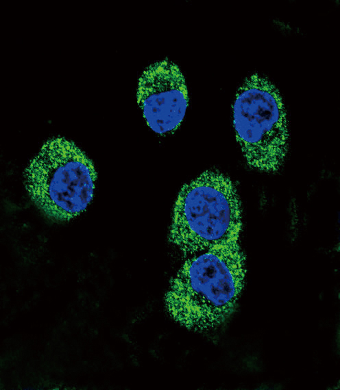 Rabbit Polyclonal Antibody to RAGE