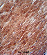 Rabbit Polyclonal Antibody to IL2