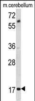 Rabbit Polyclonal Antibody to MOBP (N-term)
