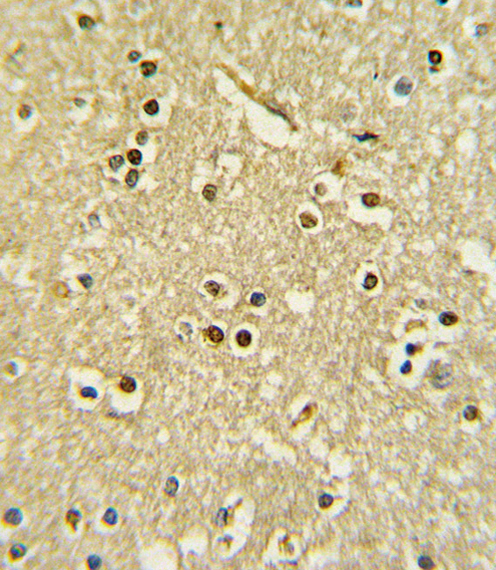 Rabbit Polyclonal Antibody to PAX6