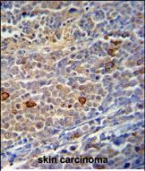 Rabbit Polyclonal Antibody to C9orf156