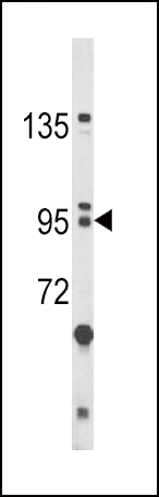 BICC1 (N-term)