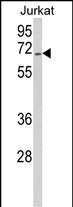 RBM14