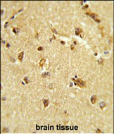 Rabbit Polyclonal Antibody to RBM14