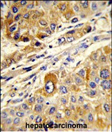 Rabbit Polyclonal Antibody to MASTL