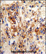 Rabbit Polyclonal Antibody to CYP2J2 (N-term)