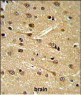 Rabbit Polyclonal Antibody to DPP10