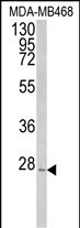 PEX11A (N-term)