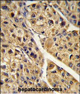 Rabbit Polyclonal Antibody to PEX11A (N-term)