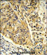 Rabbit Polyclonal Antibody to CLTA