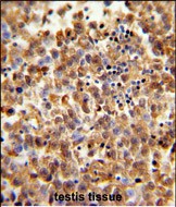 Rabbit Polyclonal Antibody to CLGN