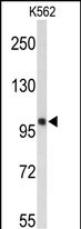 HSPH1