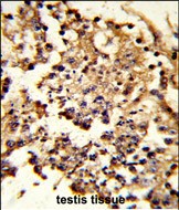 Rabbit Polyclonal Antibody to HSPH1