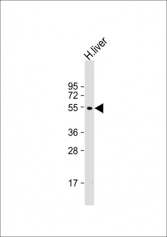Rabbit Polyclonal Antibody to CYP2C19 (N-term)