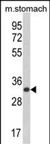 CDIPT