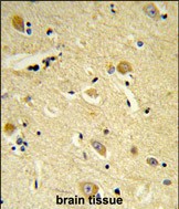 Rabbit Polyclonal Antibody to CDIPT