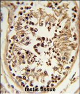 Rabbit Polyclonal Antibody to CHPF