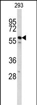 CDC14B