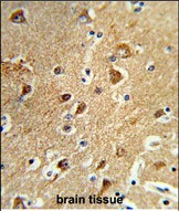 Rabbit Polyclonal Antibody to PPM1H