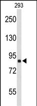 TNPO1 (N-term)