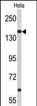 NUP153 (N-term)