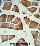 Rabbit Polyclonal Antibody to DIPA
