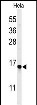 GABARAPL1