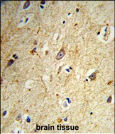 Rabbit Polyclonal Antibody to GABARAPL1