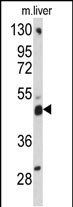 ACBD5 (N-term)