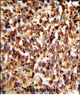 Rabbit Polyclonal Antibody to ACBD5 (N-term)