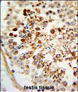 Rabbit Polyclonal Antibody to COX6A1