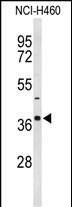 SLC25A17 (N-term)