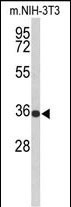 Rabbit Polyclonal Antibody to SLC25A17 (N-term)