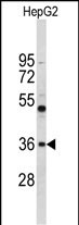 ELOVL2 (N-term)