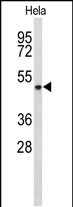ADH6