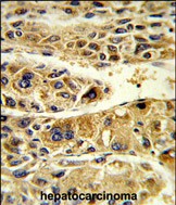 Rabbit Polyclonal Antibody to ADH6