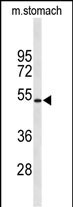 KCNJ11 (N-term)