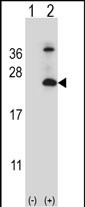 Rabbit Polyclonal Antibody to TSPAN6