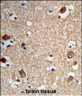 Rabbit Polyclonal Antibody to ACTR5