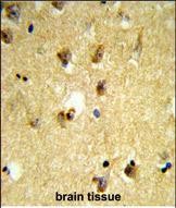 Rabbit Polyclonal Antibody to KCTD12