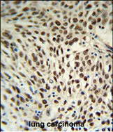Rabbit Polyclonal Antibody to SNRPD3