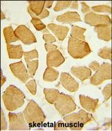 Rabbit Polyclonal Antibody to EYA4