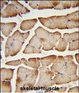 Rabbit Polyclonal Antibody to T150A