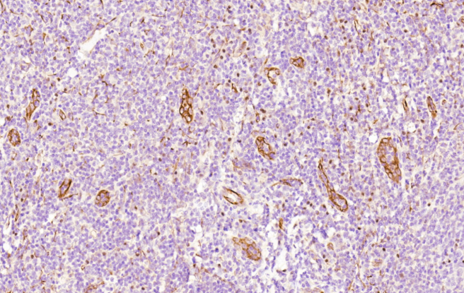 Mouse Monoclonal Antibody to CD34
