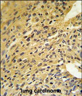 Rabbit Polyclonal Antibody to COQ5