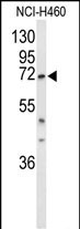 DDX17 (N-term)