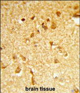 Rabbit Polyclonal Antibody to DDX17 (N-term)